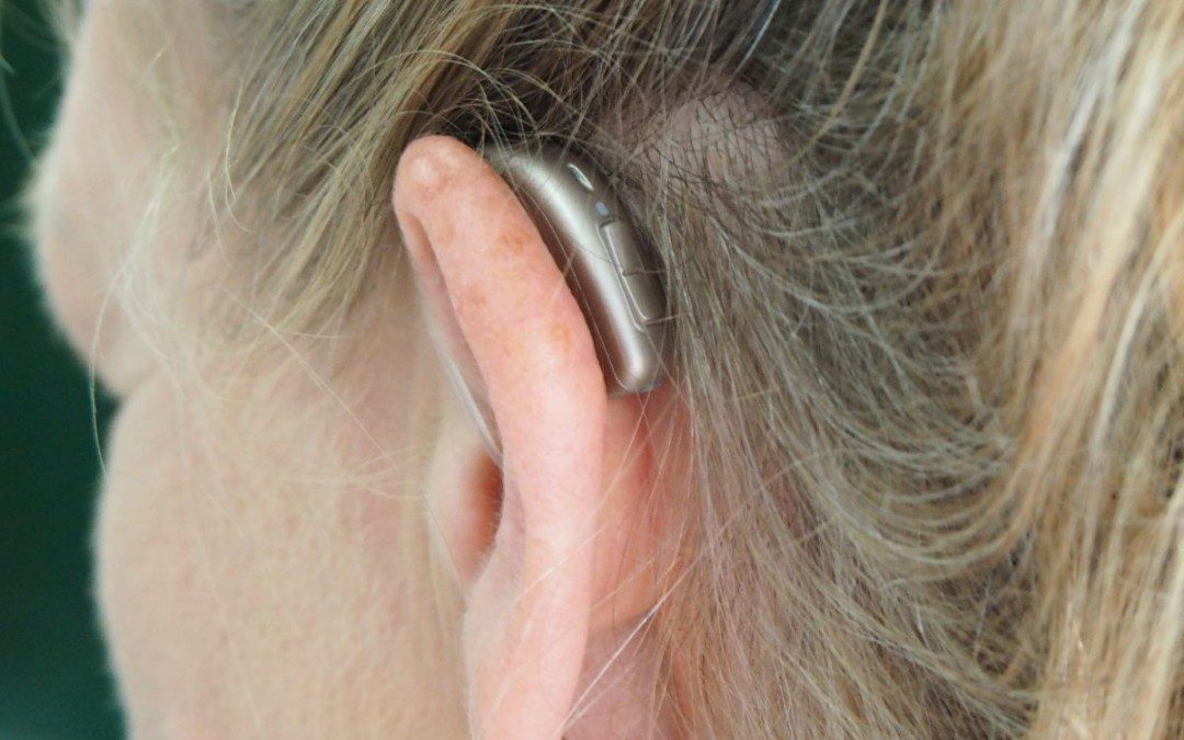 Shopping for Hearing Aids? Consider These Factors